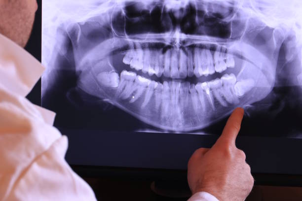 Best Emergency Broken Tooth Repair in Glasco, NY