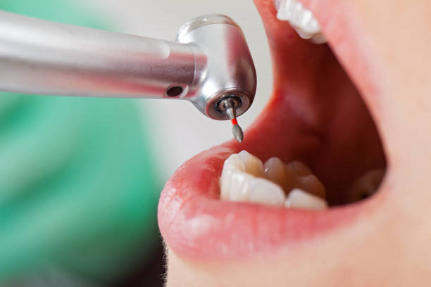 Best Emergency Treatment for Toothache in Glasco, NY